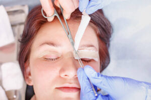 young women getting eyelid surgery