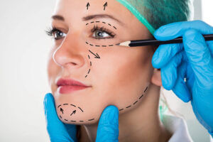 cosmetic surgeon drawing lines on face