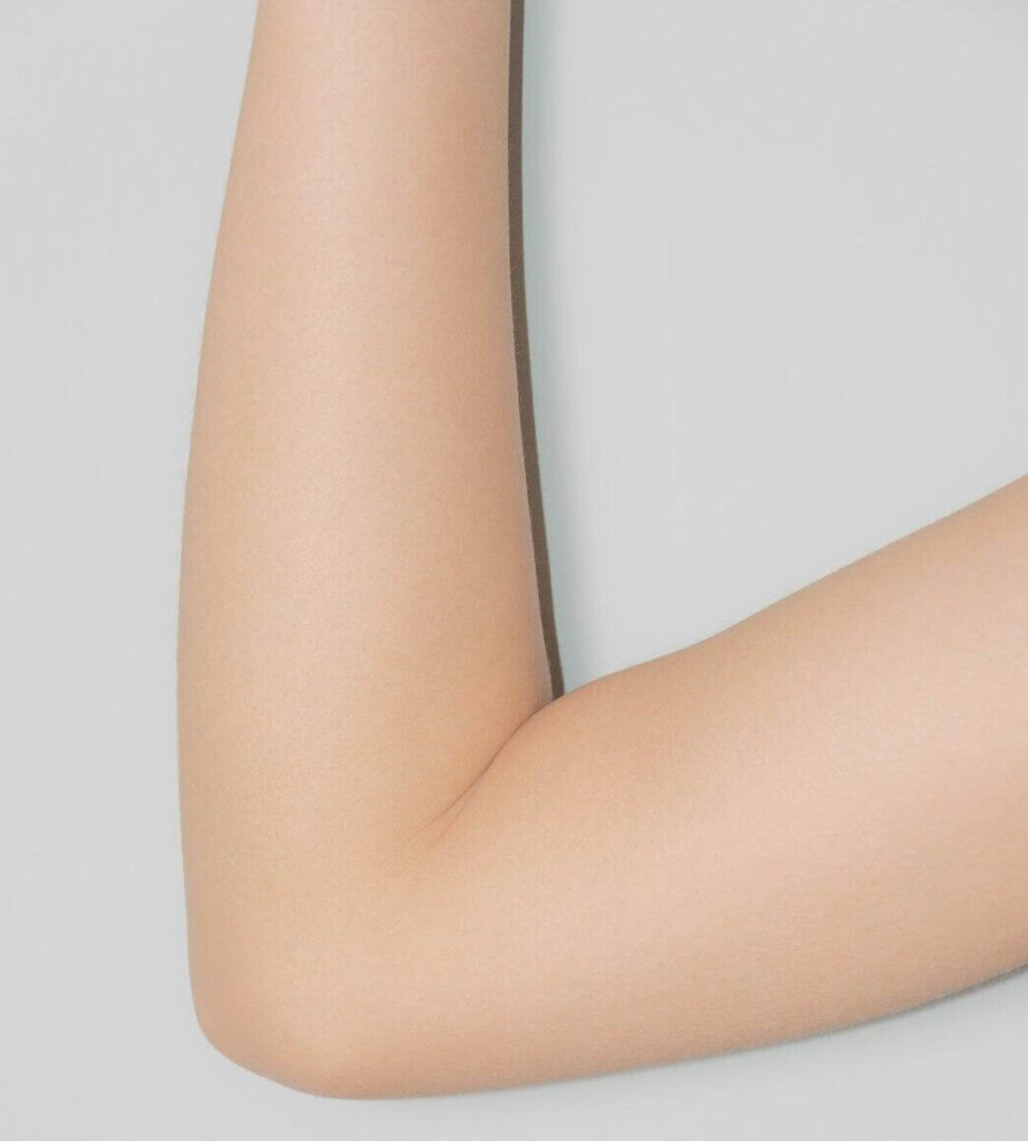 arm liposuction